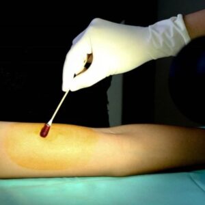 Công dụng của Povidone Iodine